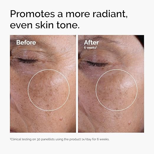 The Ordinary Glycolic Acid 7% Exfoliating Toner, Brightening